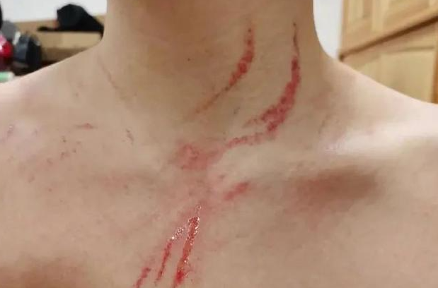 华商头条|胸口全是血痕！中国水球女将晒照霸气回怼外国运动员