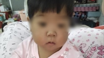 20万肝移植费用难倒单亲母亲：2岁儿子患肝衰竭肝硬化 丈夫患肝癌去世