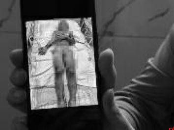 ICU里的祖孙俩急需你的援助