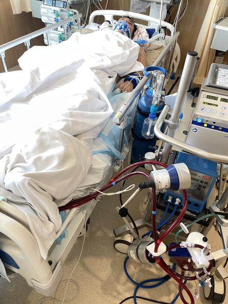 男子突发心肌梗死在ICU靠人工心肺维持生命 妻子向社会求助