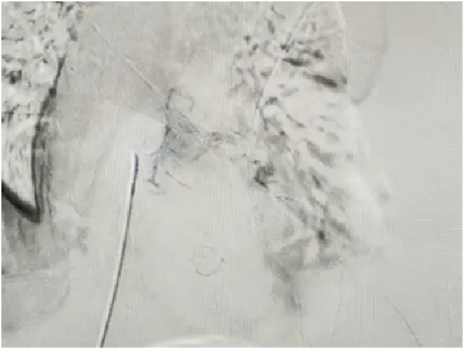 BoPN1On8inH85wmi.png image.png