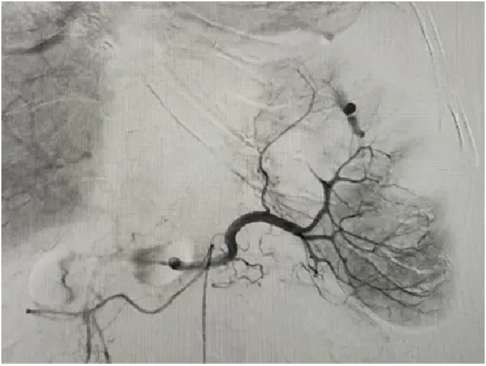 TspTVpHUAjCE7z9T.png image.png