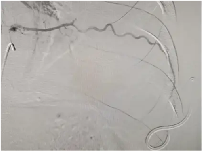 a6GIKFrHlDdhAkyp.png image.png