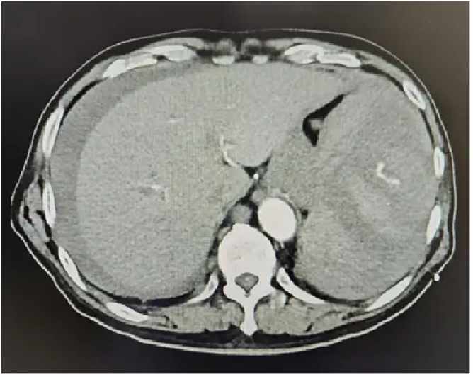 piouI550yhvgbDm6.png image.png