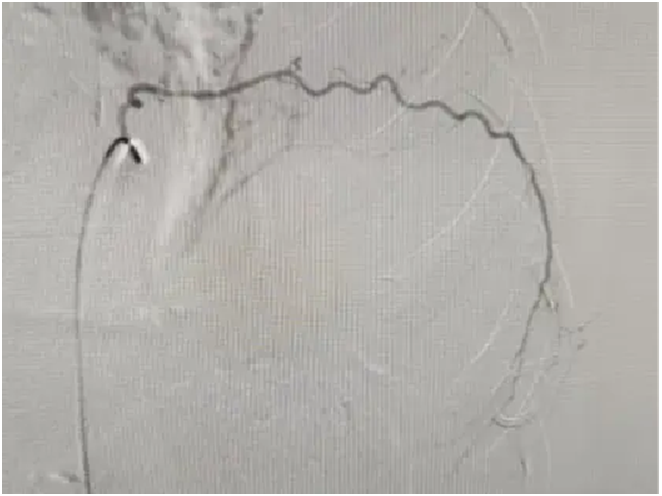 yMFVOwAEf05PeYE0.png image.png