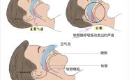 以前睡觉不打呼噜现在打呼噜可能有大问题