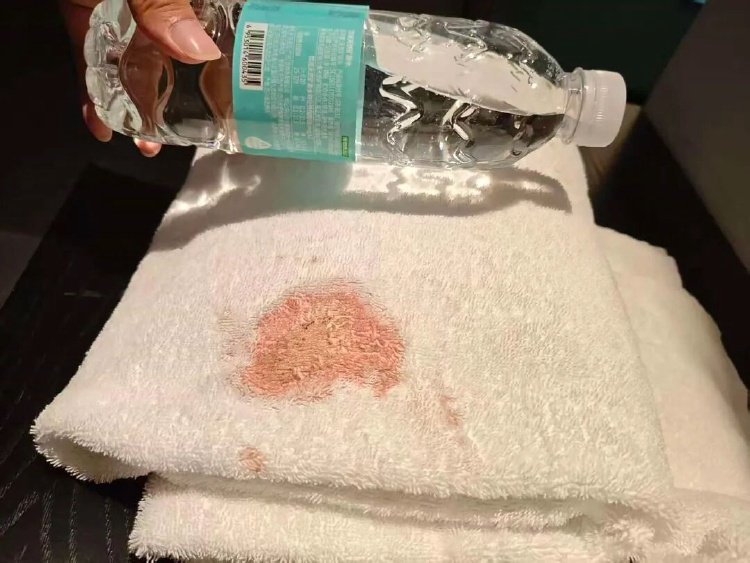 男子发现酒店浴巾有大片血迹担心染病要求赔偿 酒店回应