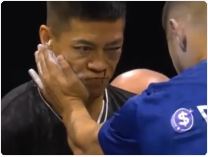 中国男子参加扇耳光大赛倒地 本人发声