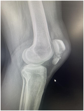 8ADFdwhlpFSJMfiR.png image.png