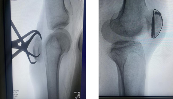 Km8faaTXokannnwO.png image.png