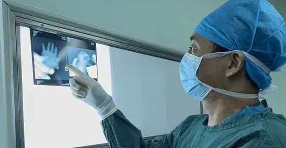 西北大学第一医院为宝宝重塑“完美”小手