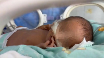 江西卫健委通报一早产儿因病情危重离世：家属已提起诉讼