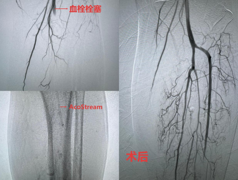 zzcBFUBwUjoU5hcn.png image.png