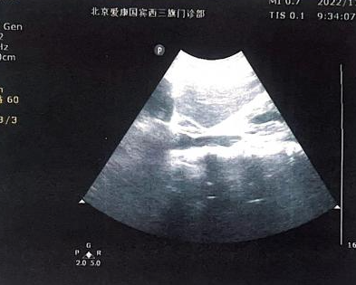 患癌女律师收到北京卫健委答复：未发现体检结果造假