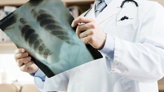 今后看病将告别胶片！“医保影像云”四项规范公开征求意见