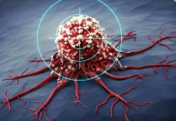 首次揭示！我国0至19岁癌症患者5年生存率为77.2%