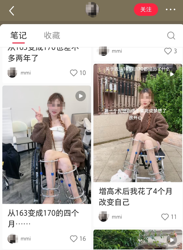 在小红书上，仍有宣介“断骨增高术”的账号（截图）