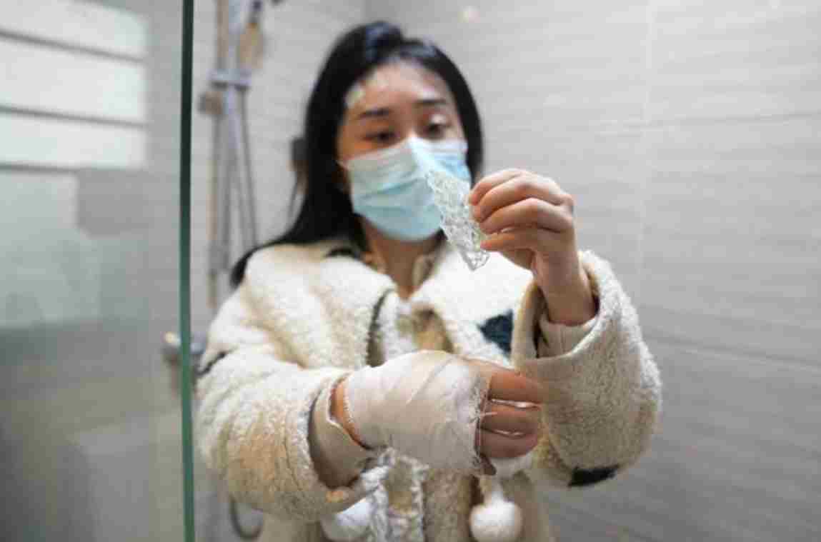 女子洗澡时浴室玻璃突然自爆致受伤 开发商：已超质保期