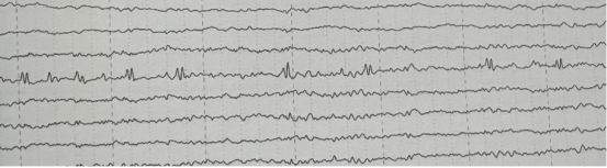 jgFEM6xO93ss4DpY.png image.png