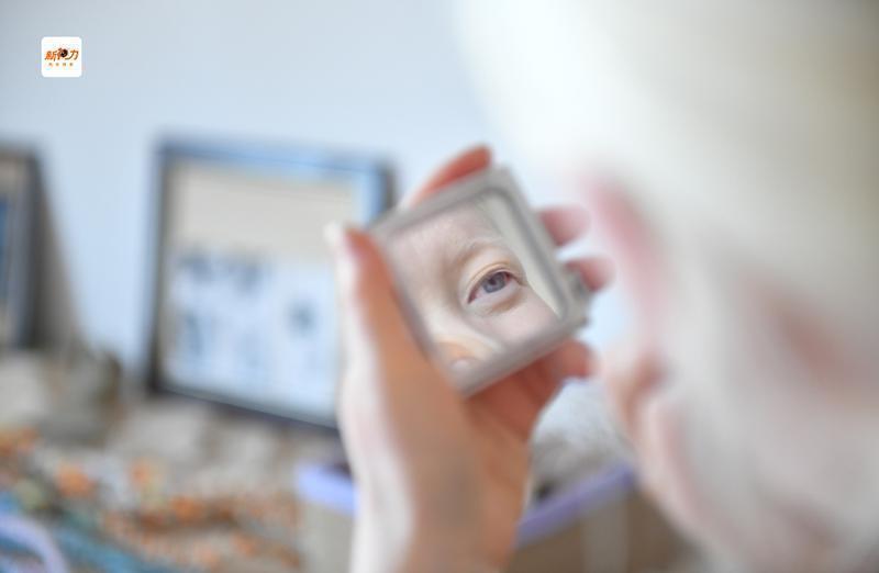 白化病患者的虹膜通常会因黑色素缺乏而呈现出较浅的颜色。