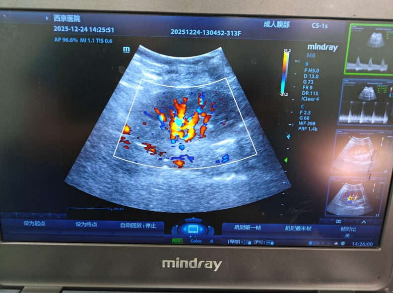 zVOtq3bO7Wipu30O.png image.png