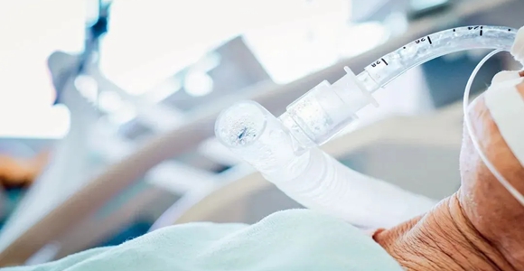 不拔管，百万赔偿就没了