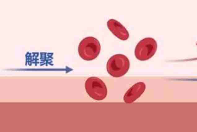 西工大团队精准量化血液流变 为心血管疾病模拟诊断提供科学支撑