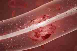 如何精准模拟血液流动？西工大团队为血管“画像”