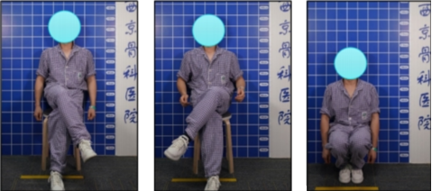 5术后第二天功能照