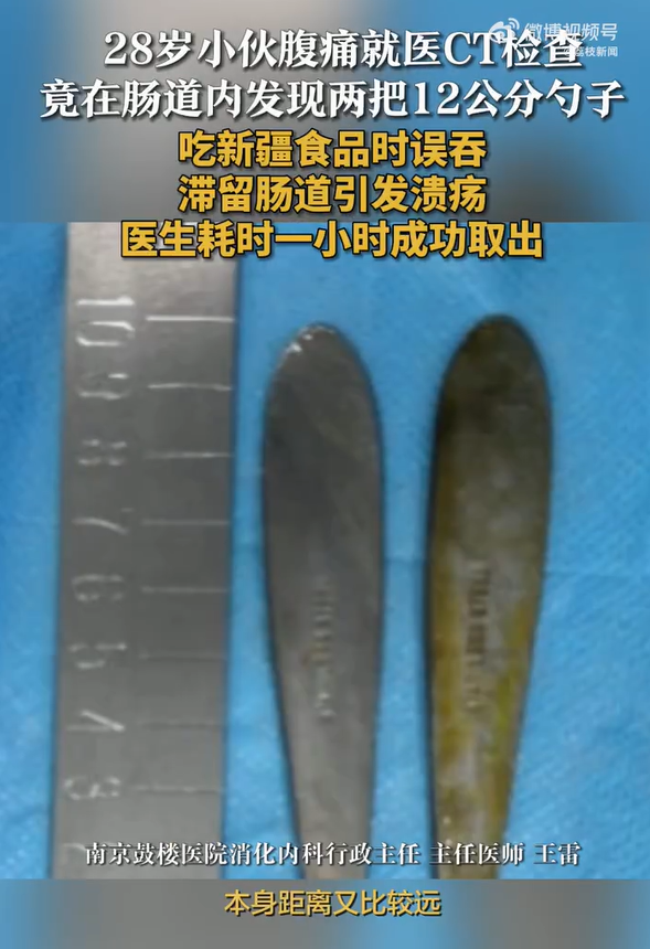 eaDygoCd7JFGACLP.png 44a86ee193567b47354158d434b6502d_1f679d489b.png