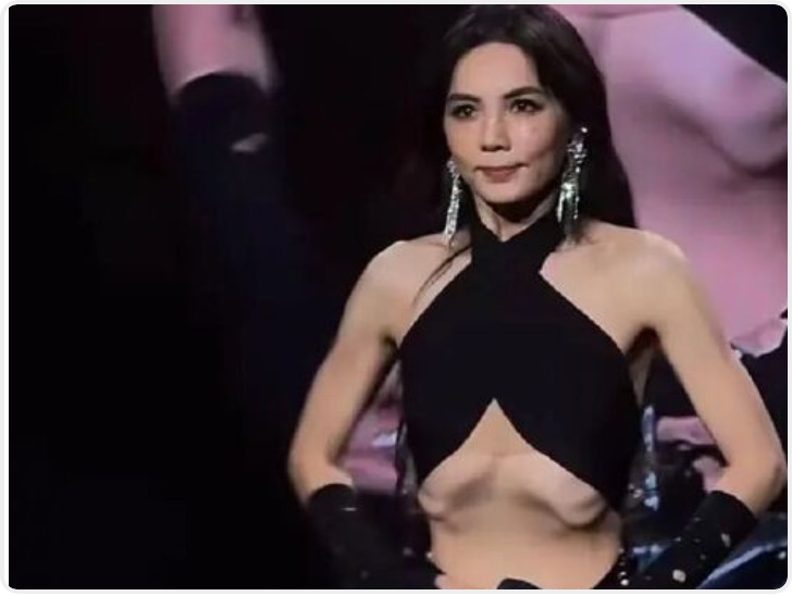 Ella陈嘉桦演唱会展示“真空腹”引热议 医生科普：并非健康减脂