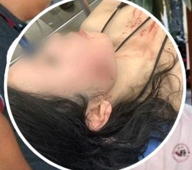 中国女游客在泰国射击场被流弹击中 脸部严重受伤被送医 