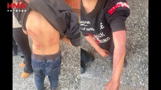 湖南武冈姐弟遭继母生父长期虐待 老师邻居被威胁别管闲事