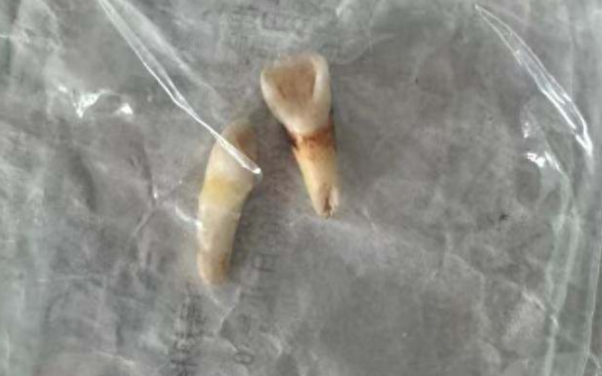 襄阳10岁男孩被母亲同居男友打成轻伤二级 施暴者被刑拘