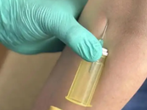 降至300元的降脂针纳入医保 医生：没“打针后暴瘦”案例