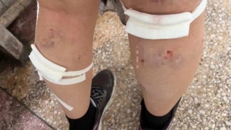 平顶山学院通报学生被流浪狗咬伤：伤情平稳 对动物专业处置