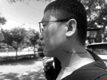 风筝线又伤人