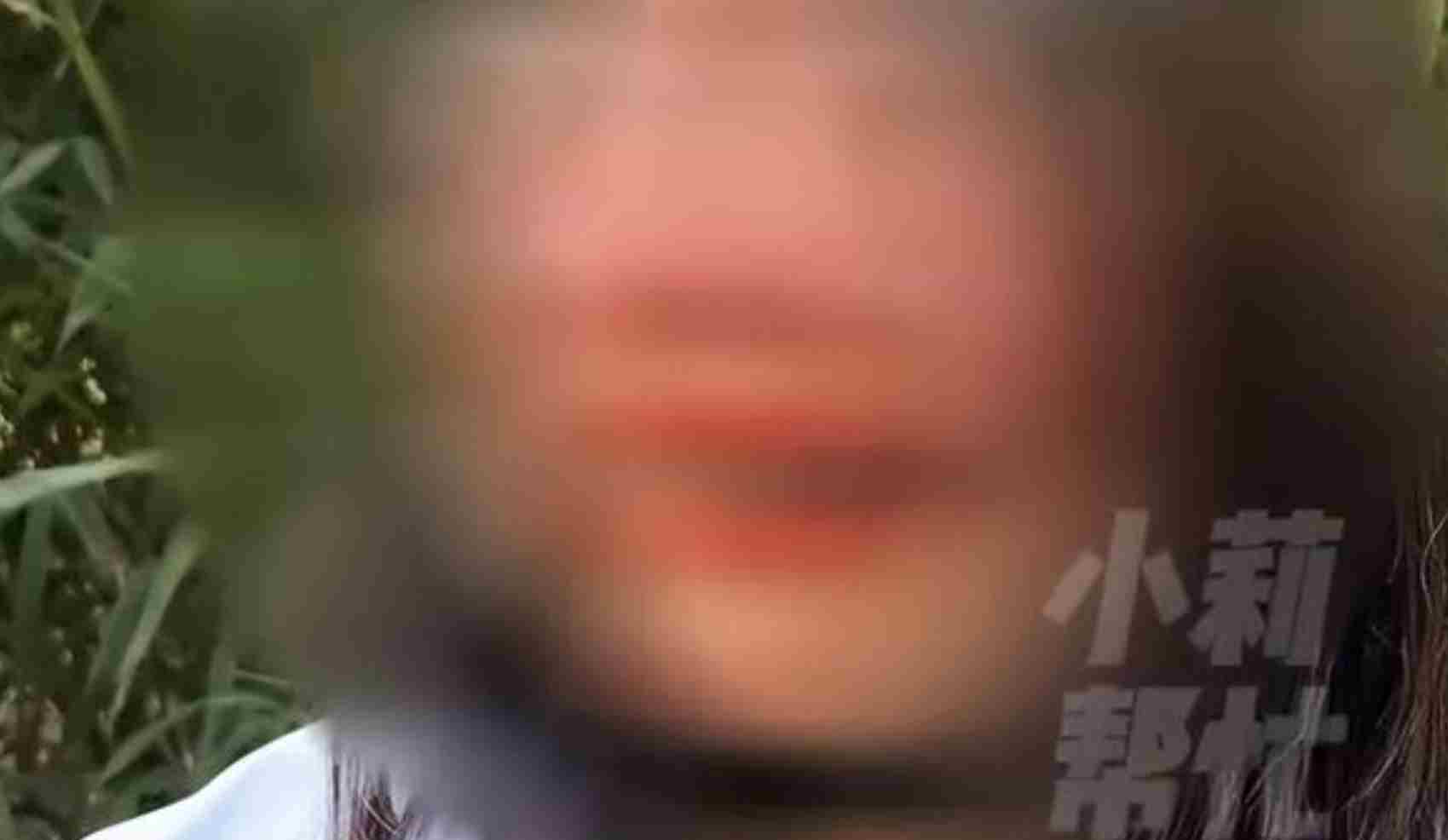 男子月薪涨至6万后频繁家暴 嫌女儿长得丑让自己丢人