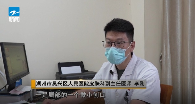 女子做美甲感染HPV！医生提醒