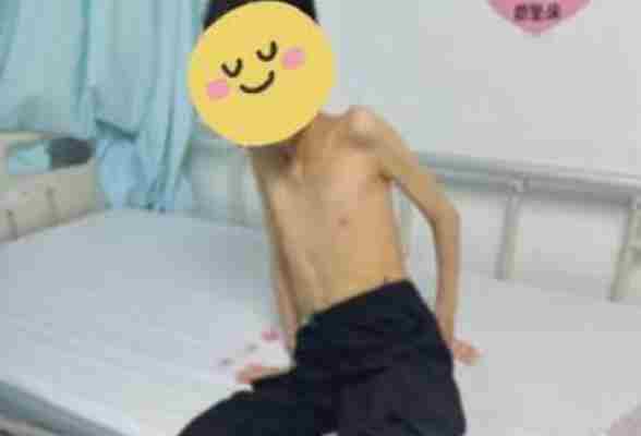 17岁少年身高1.5米体重仅21公斤 患多种疾病无法站或坐