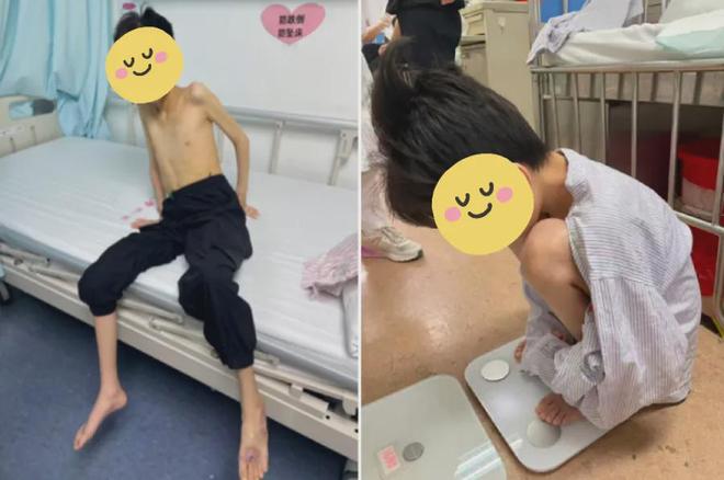 17岁少年身高1.5米，体重仅21公斤，身患多种疾病无法站或坐