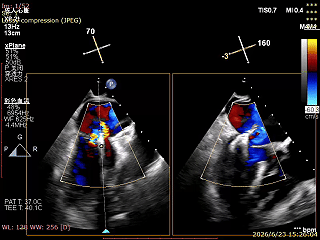wKpEA2m0rBmc92CU.png image.png