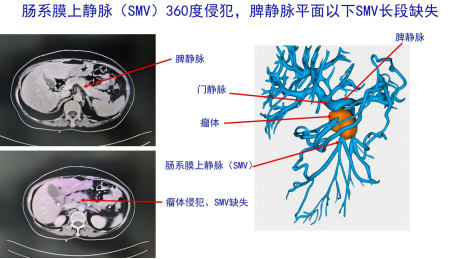5O9XlL71Bd9Dglim.png image.png