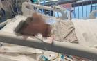 45岁产妇心跳骤停抢救52天身亡 医疗事故鉴定3次反转