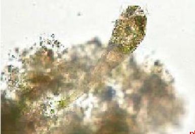 鄱阳湖流域发现全球新物种“九江喇叭虫”