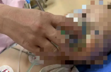 1岁宝宝吃下毒鸡蛋进ICU 邻居自首称是为了“毒黄鼠狼”