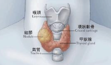长期晚睡成了常态 15岁学生确诊甲状腺癌